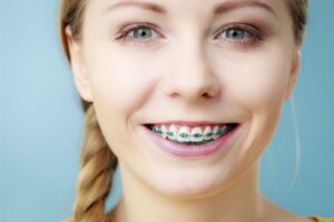 Riverton Braces